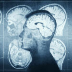 MRI scans of the brain displayed alongside a silhouette of a human head