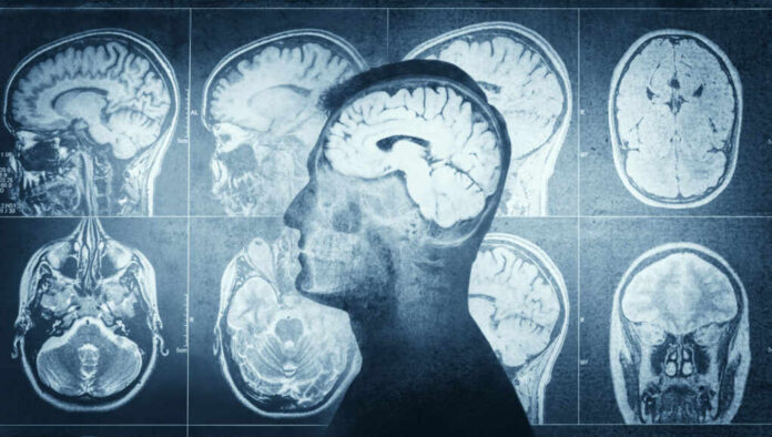 MRI scans of the brain displayed alongside a silhouette of a human head
