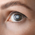 Blind Patients See Again! Here’s How Close-up view of a human eye showcasing the iris and eyelashes
