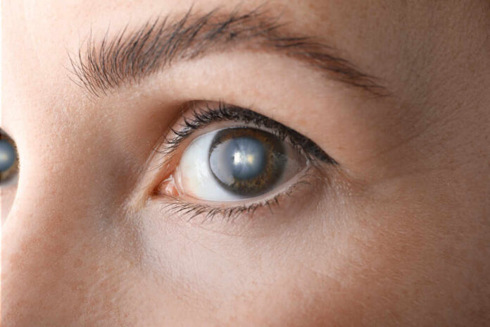 Close-up view of a human eye showcasing the iris and eyelashes