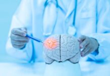 The Hidden Balance Thief in Your Brain Doctor examining a model of a brain with a pen