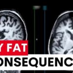 Could Your Belly Fat Alter Brain Health? Study reveals belly fat linked to increased dementia risk | 7NEWS