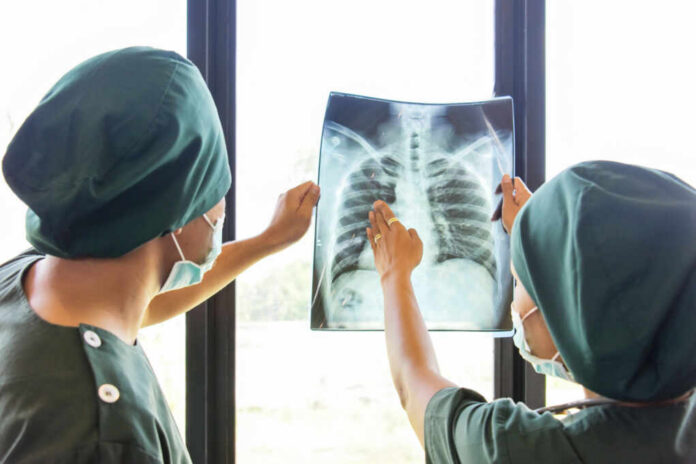 Two medical professionals examining an x-ray of a chest