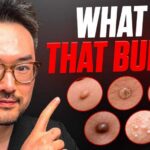 Lumps and Bumps On Your Skin | Dr. Danny Guo
