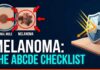 Melanoma – How to Spot Silent Warning Signs Skin Cancer Warning Signs: How to Spot Melanoma Early | Clinical Protocol