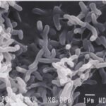 Bacteria under scanning electron microscope