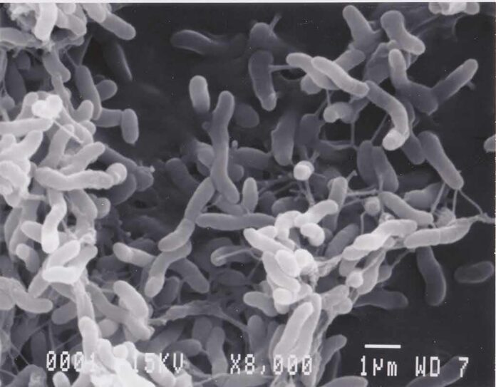 shutterstock_1868642461 Bacteria under scanning electron microscope