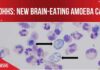 New brain-eating amoeba case in NC: What you need to know