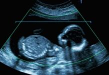Built-In Arthritis? Womb Clue Shocks Doctors Fetal ultrasound scan image