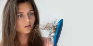Woman holding a hairbrush with clumps of hair